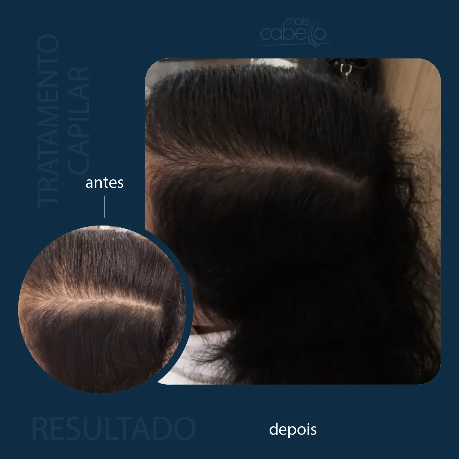 Antes e Depois - Rarefação na Risca